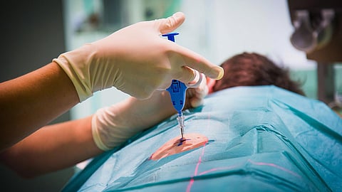 أخذ خزعة من مريض  