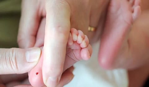 فحص حديثي الولادة