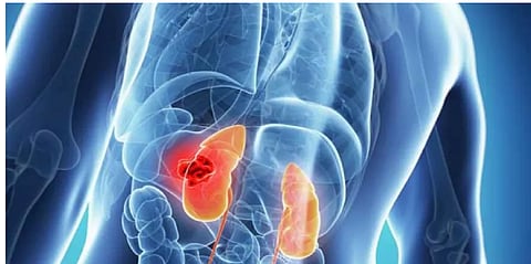 أمراض الكلى  