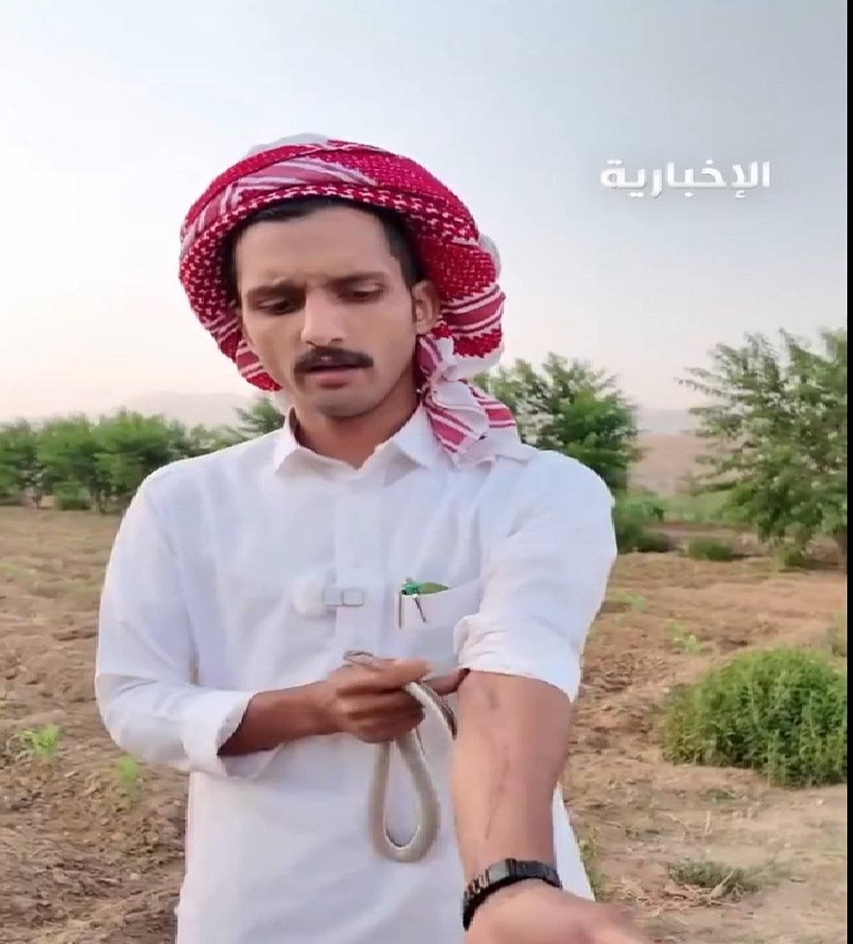 مواطن يروي قصة نجاته من لدغة أفعى قاتلة مواطن يروي قصة نجاته من لدغة أفعى قاتلة