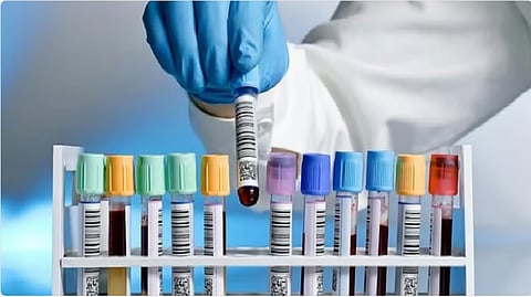 استشارية توضّح التطعيمات الهامة للمرأة قبل الزواج