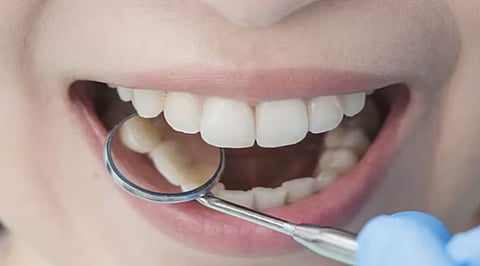 مختصة: 5 أسباب وراء تسوس الأسنان