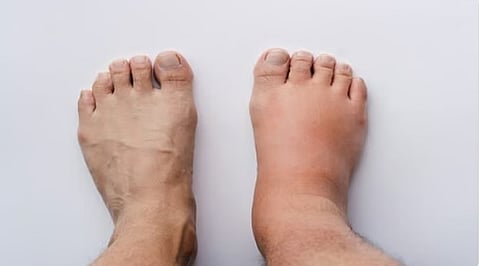 استشاري: 7 عوامل تسبب حرارة القدمين