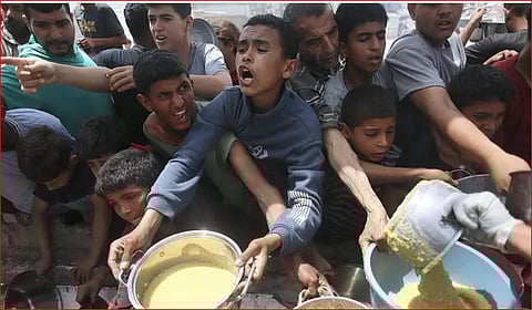 مجمع الشفاء الطبي: وفاة 21 طفلًا جراء المجاعة في غزة