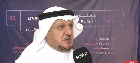 ما أسباب سرعة إجراءات عمليات فصل التوائم السيامية؟.. مسؤول يوضح