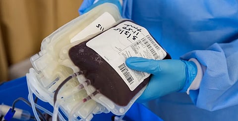 طبيب: التطور الطبي سبب زيادة أعداد المتبرعين بالأعضاء الأحياء  