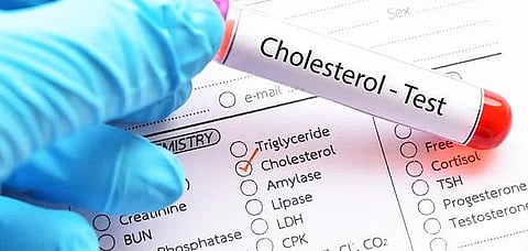 «فهد الطبية» توضح عوامل خطر الإصابة بارتفاع الكوليسترول