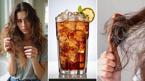 دراسة حديثة تحذر: السكريات تزيد تساقط الشعر