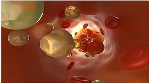 الخضيري يوضح أسباب ارتفاع الكلسترول وعلاجه