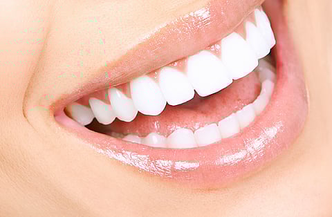 أخصائي: ربط ابتسامة هوليود بالتركيبات والعدسات مفهوم خاطيء