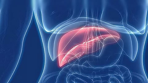 «فهد الطبية» توضح عوامل خطورة الإصابة بمرض الكبد الدهني وطرق الوقاية منه