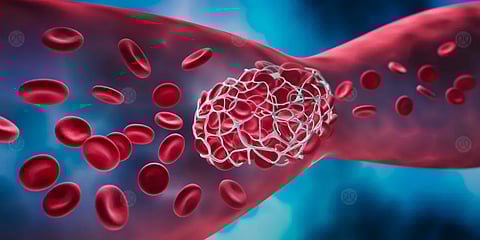 علماء يبتكرون جسيمات نانوية آمنة تمنع الجلطات الدموية