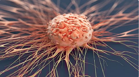 استشاري: 5 أصناف من الأغذية ترتبط علميا بالسرطان