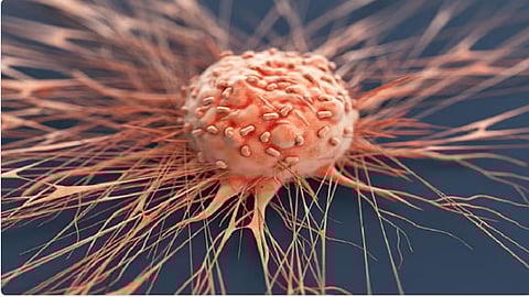 علاج ثوري يقضي على أورام سرطان المثانة لدى معظم المرضى