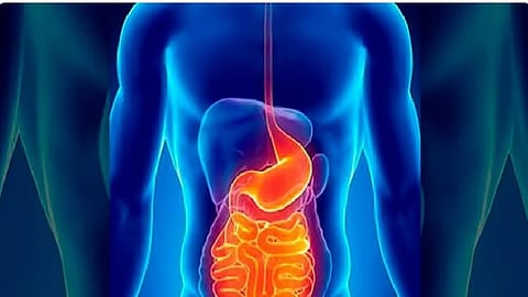 استشاري: 4 أعراض لنزيف الجهاز الهضمي