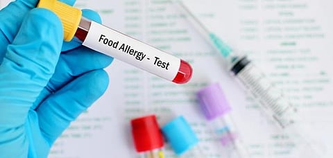 هل يوجد اختبار طبي دقيق لتأكيد الإصابة بحساسية الطعام أو استبعادها؟.. توضيح من الصحة