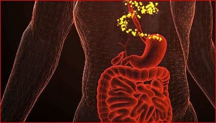 استشاري: 7 عوامل لخطورة سرطان القولون
