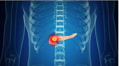 استشاري: 4 أعراض لمشكلات البنكرياس في الجسم