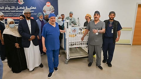 نجاح فصل التوأم الملتصق الصومالي «رحمة ورملا» بعد عملية جراحية معقدة استغرقت 12 ساعة