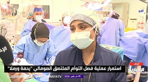 استشارية: عمليات فصل التوأم صعبة ومعقدة ويدخل بها 6 تخصصات 