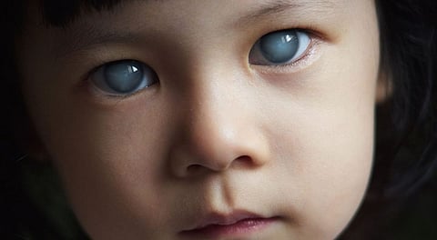 جلوكوما العين: كيف تحمي بصرك من “السارق الصامت” للبصر؟- الكحال

