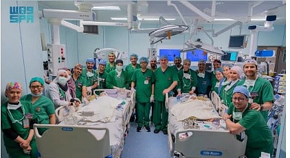 الفريق الطبي يستكمل فصل التوأم الملتصق "كليا وموريس آن" بعد عملية جراحية معقدة