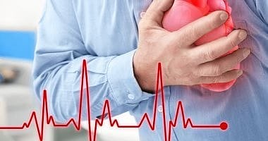 استشاري قلب: 50% من الجلطات تضرب دون سابق إنذار  