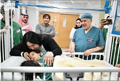 اكتمال فصل التوأم الفلبيني الملتصق ضمن المرحلة الرابعة من العملية