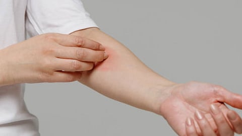 أسباب إصابة مرضى السكري بالحكة.. وكيفية علاجها