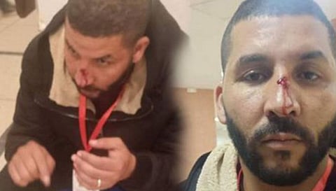 لاعب مغربي يعتدي على مصور صحفي بضربة رأسية في الأنف