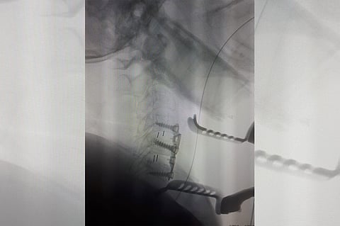 تدخل جراحي ناجح ينهي معاناة مريضة بحفر الباطن