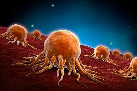 فريق بحثي يكتشف مادة مدمرة للأورام السرطانية بحليب الأم