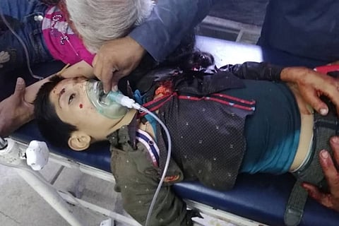بالصور.. عدوان أردوغان يفتك بالأطفال والنساء في شمال سوريا
