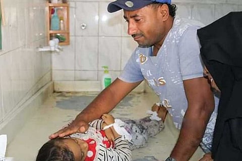 جريمة جديدة.. رصاصة قناص حوثي تنتزع حياة طفلة الأربعة أعوام في تعز