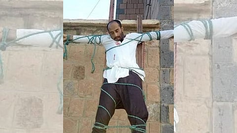 تفاصيل مفزعة في مقتل الطبيب اليمني.. زوجته فشلت في ابتزازه ماديًا فأبلغت عنه تنظيم القاعدة فصلبوه