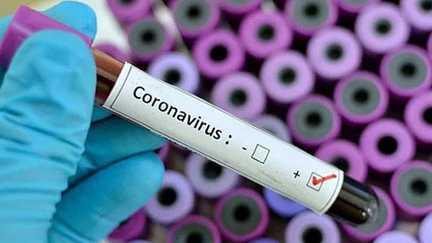 الصحة توجِّه بإجراءين للوقاية من كورونا والالتهابات التنفسية الأخرى