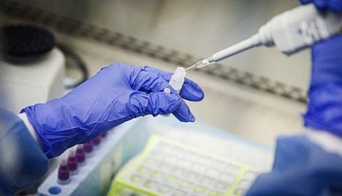 The health ministry is continuing to expand the exercise of conducting tests and is launching specialist laboratories for conducting the tests with the highest quality standards.

