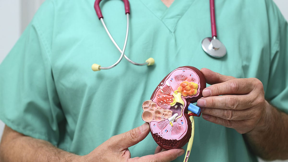 ابتكار أداة مدعومة بالذكاء الاصطناعي للكشف المبكر عن سرطان الكلى 