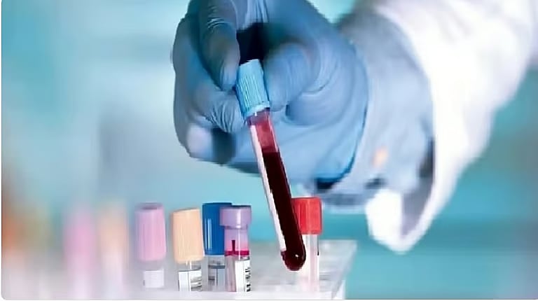 استشارية توضح حالات تستدعي إجراء التحاليل الدورية