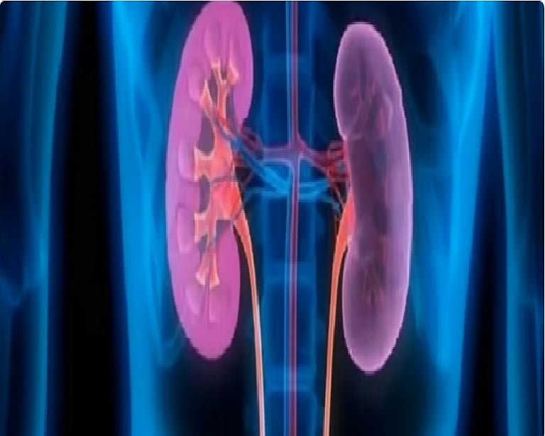 استشاري: يمكن تحسين وظائف الكلى في الكثير من الحالات 