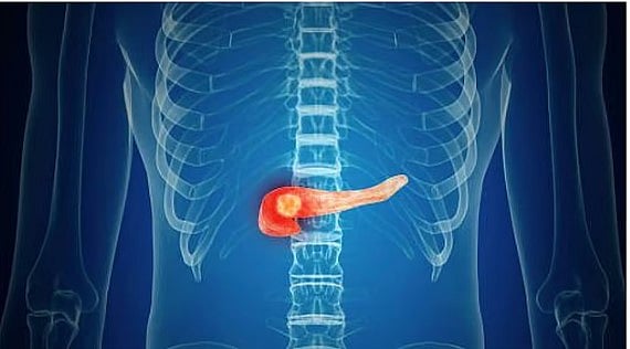 استشاري: 4 أعراض لمشكلات البنكرياس في الجسم 