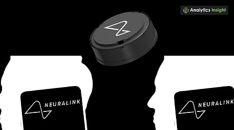 Musk's Neuralink Hits Milestone: Ninth Patient Gets Brain Chip Implant