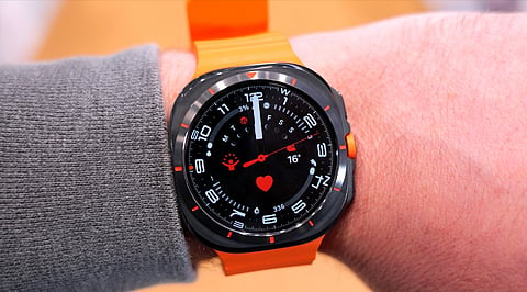 How-a-Samsung-Galaxy-Watch-Flagged-a-Possible-Heart-Rhythm-Problem.jpg