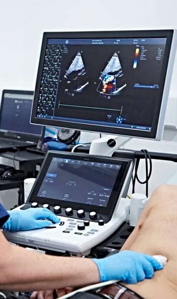 Echo: Provides robust features including middleware, routing, and HTTP handling, enabling developers to build high-performance APIs with minimal boilerplate and excellent scalability.