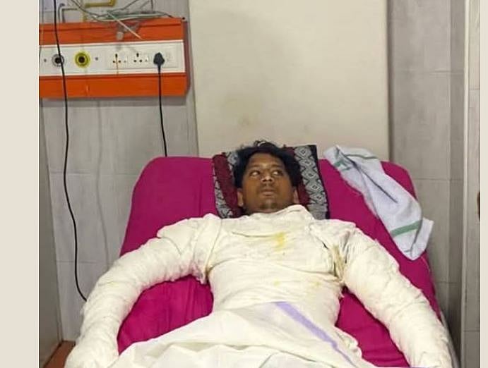 எரிக்கப்பட்ட இராணிப்பேட்டை இளைஞர் உயிரிழப்பு!  