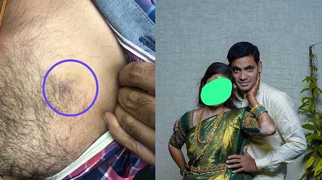 தொட்டாலே 5000 தரணும்… மனைவியின் நிபந்தனை.. போலீசுக்குப் போன கணவன்!