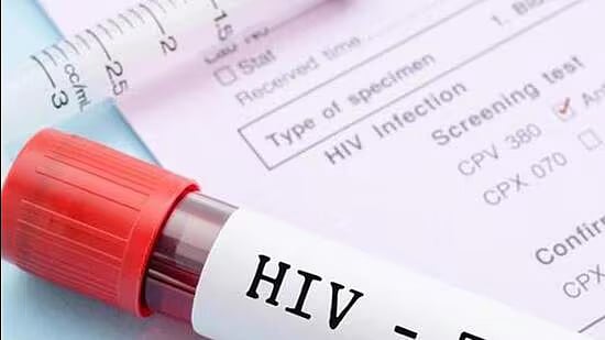 7 மாதங்களில் 200 பேர் எச்.ஐ.வி.யால் பலி!