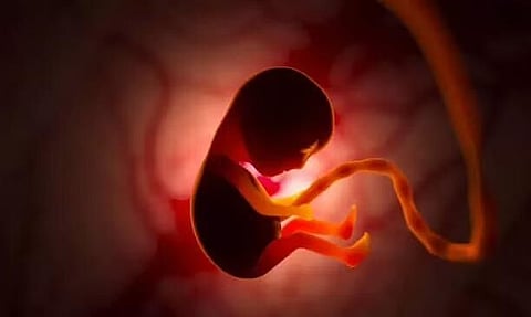 অসমঃ গোলাঘাটত কাৰ্ডবৰ্ডৰ বাকচত উদ্ধাৰ মানৱ ভ্ৰুণ