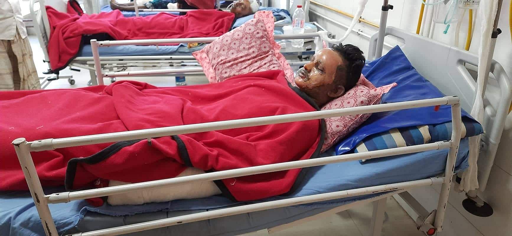 6 people burnt during gas line repairs in Dhaka’s Jurain