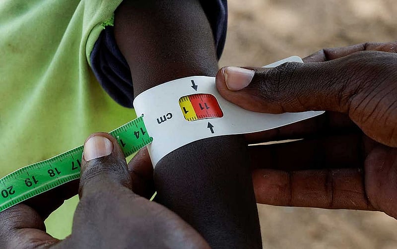 Peter Lokoyen, 4, is screened for malnutrition in Lomolem village, Turkana County, Kenya, Oct 29, 2025. REUTERS/Monicah Mwangi